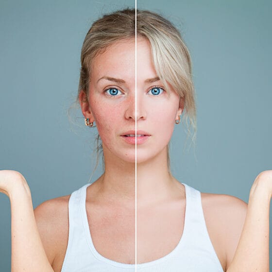 Dermatologie