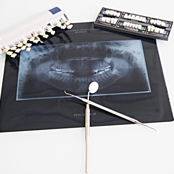 Radiologie Dentaire
